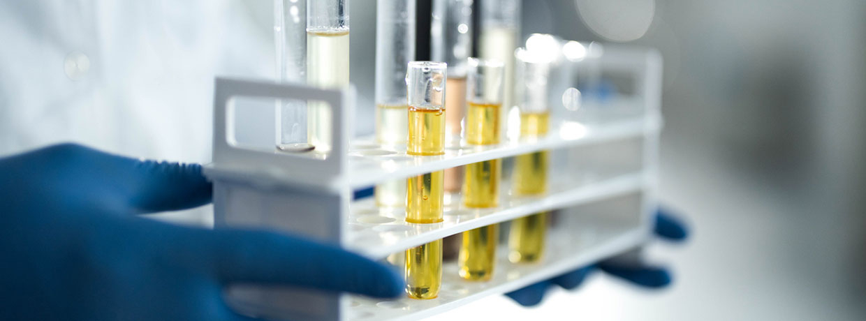 Cannabielsoxa : des chercheurs découvrent un nouveau cannabinoïde issu du chanvre