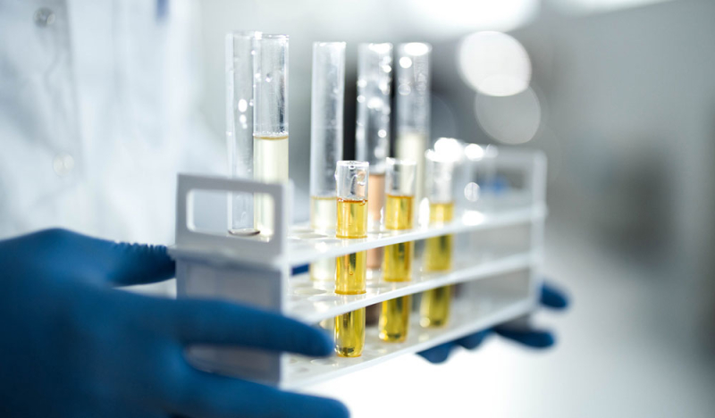 Cannabielsoxa : des chercheurs découvrent un nouveau cannabinoïde issu du chanvre